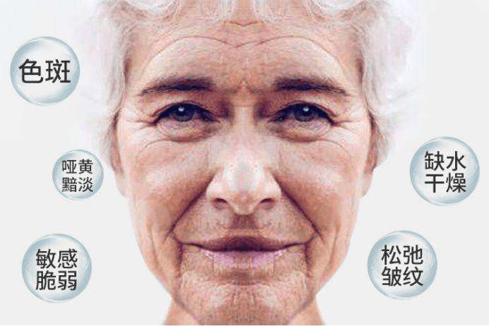 負(fù)氧離子